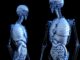 Guzki krwawnicze odbytu anatomia człowieka